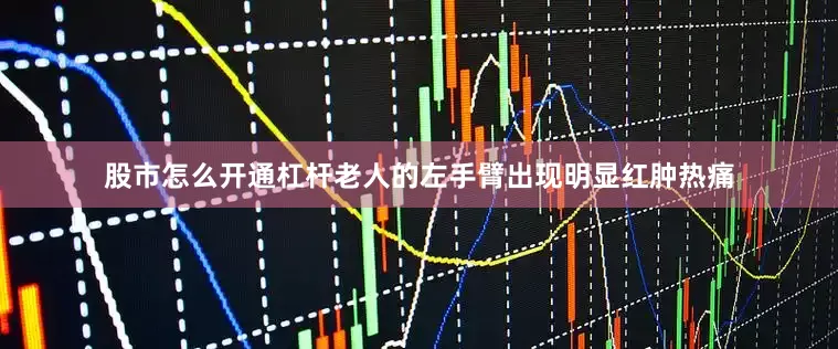 股市怎么开通杠杆老人的左手臂出现明显红肿热痛